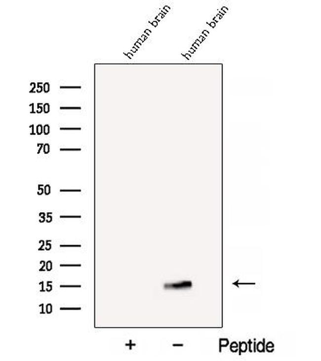 BEX1/BEX2 Antibody in Western Blot (WB)