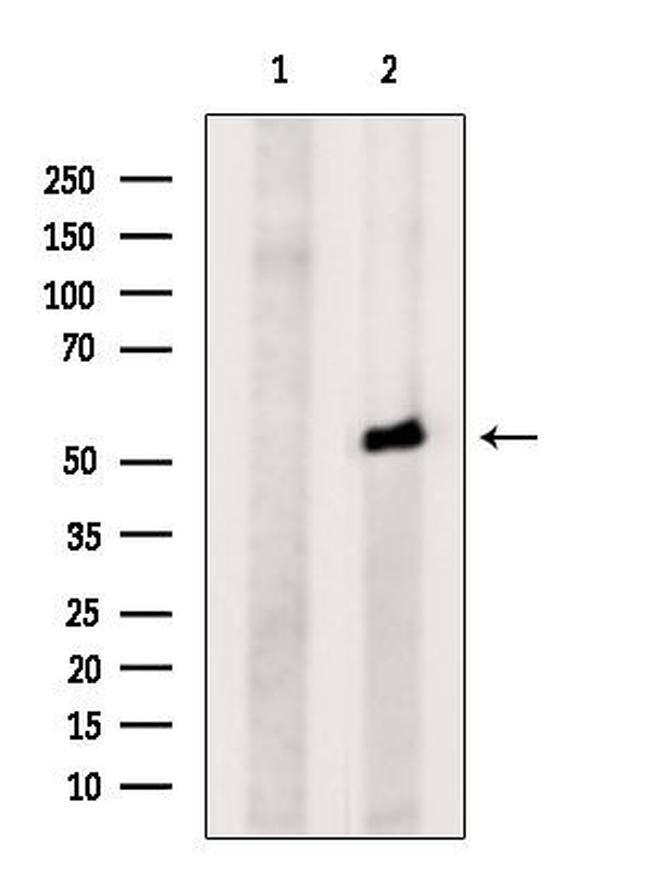 C13orf18 Antibody in Western Blot (WB)