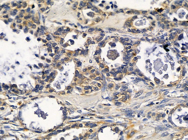 C5orf4 Antibody in Immunohistochemistry (Paraffin) (IHC (P))