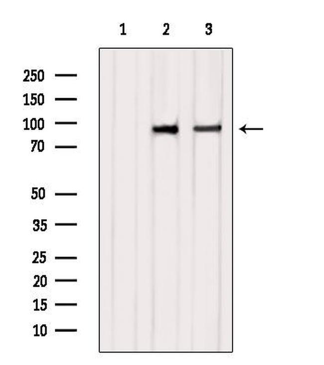 CLGN Antibody in Western Blot (WB)