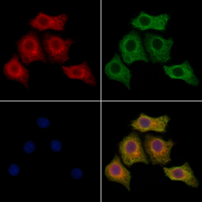 CaBP8 Antibody in Immunocytochemistry (ICC/IF)
