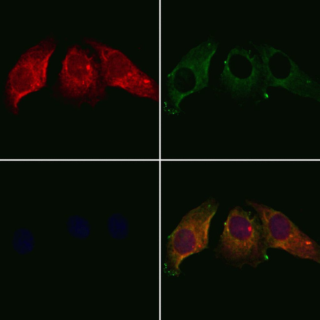 Calumenin Antibody in Immunocytochemistry (ICC/IF)