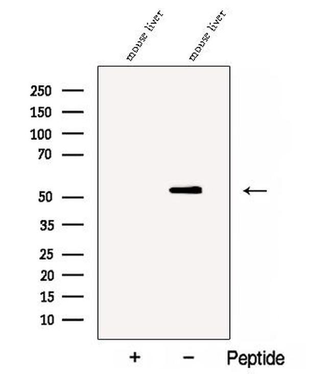 Cathepsin F Antibody in Western Blot (WB)