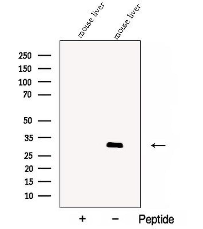 CBY1 Antibody in Western Blot (WB)