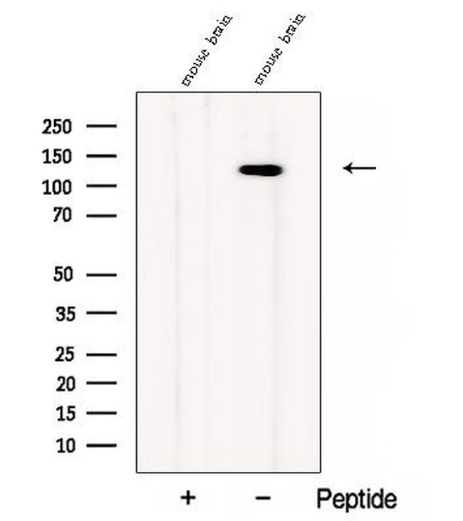 CC2D1B Antibody in Western Blot (WB)