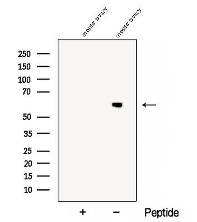 CCT6B Antibody in Western Blot (WB)