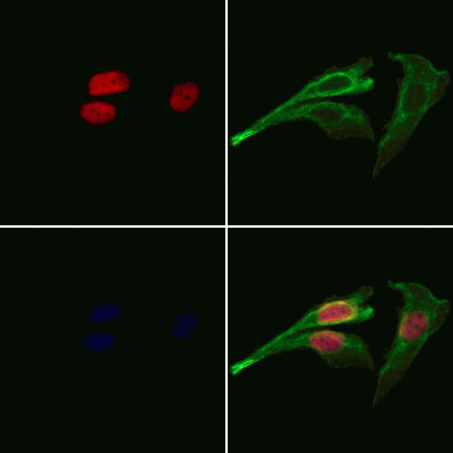 Cdc26 Antibody in Immunocytochemistry (ICC/IF)