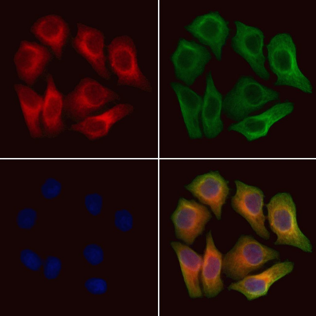 CHMP1B Antibody in Immunocytochemistry (ICC/IF)