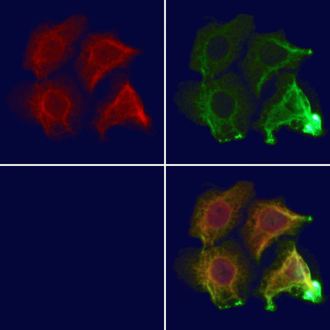 CNKSR3 Antibody in Immunocytochemistry (ICC/IF)