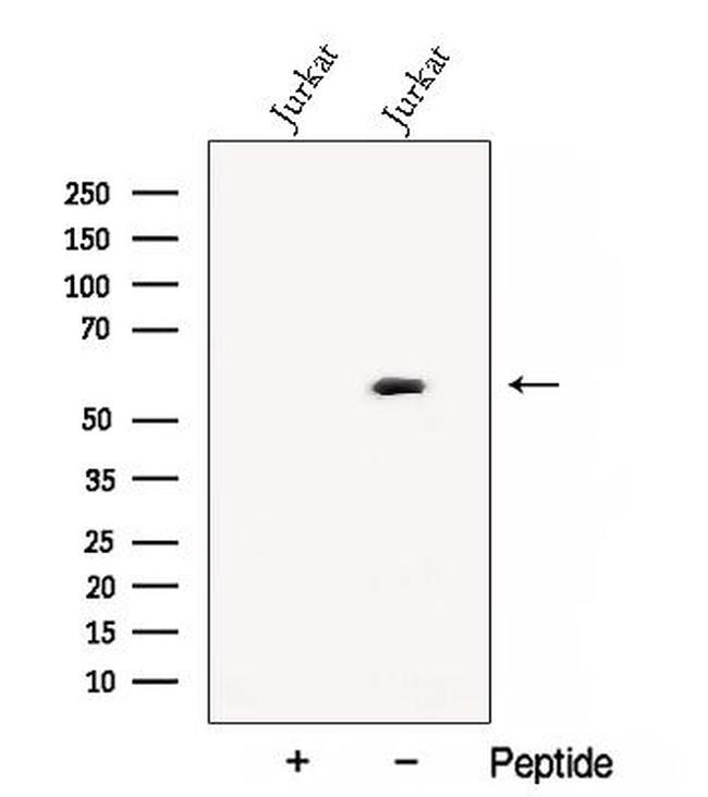 CNOT6 Antibody in Western Blot (WB)