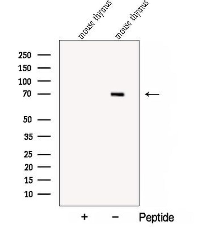 COL23A1 Antibody in Western Blot (WB)