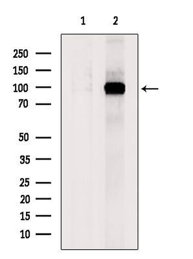 COPG2 Antibody in Western Blot (WB)