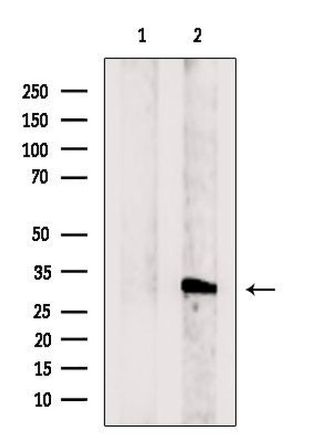 COQ5 Antibody in Western Blot (WB)