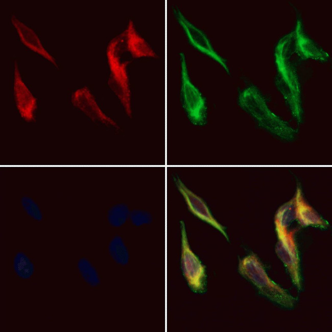 CRISP3 Antibody in Immunocytochemistry (ICC/IF)