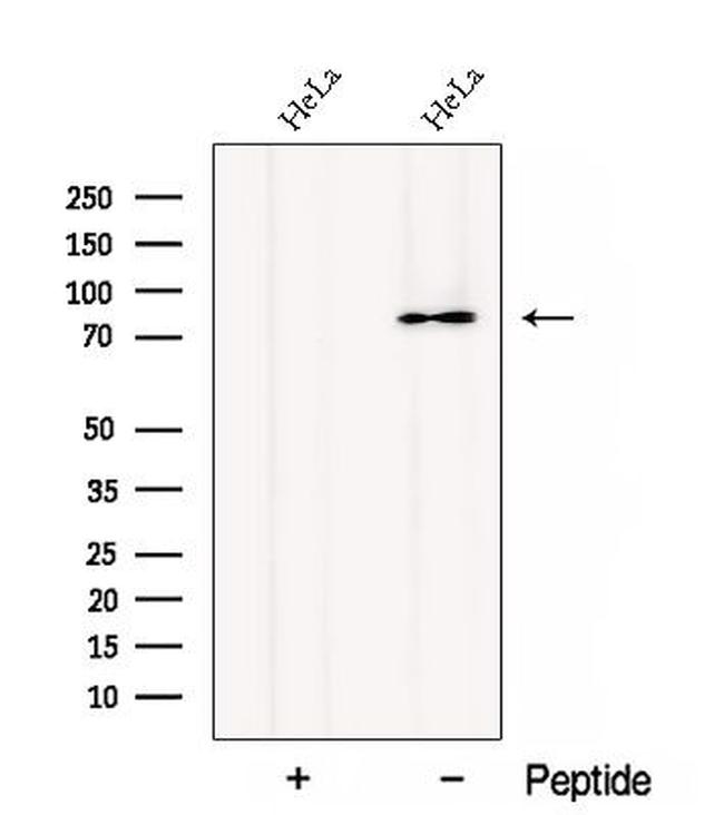 CTAGE1 Antibody in Western Blot (WB)