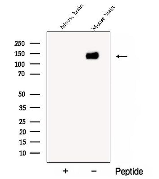 CYFIP2 Antibody in Western Blot (WB)