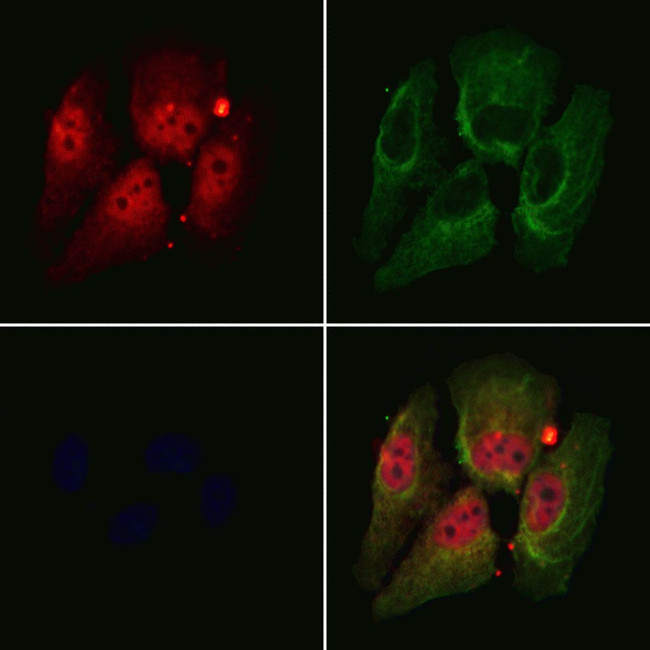 DDX17 Antibody in Immunocytochemistry (ICC/IF)