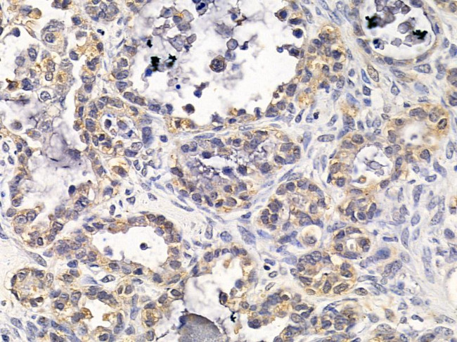 DIO2 Antibody in Immunohistochemistry (Paraffin) (IHC (P))