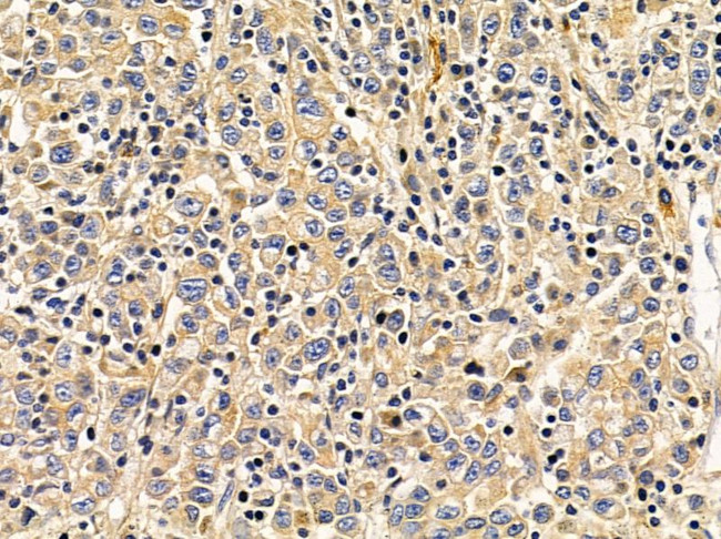 DNAJC21 Antibody in Immunohistochemistry (Paraffin) (IHC (P))