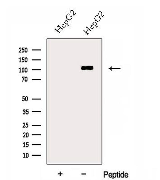 DSE Antibody in Western Blot (WB)