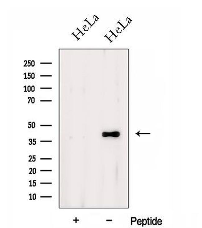 DSN1 Antibody in Western Blot (WB)