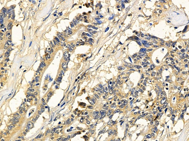 DYNC1LI2 Antibody in Immunohistochemistry (Paraffin) (IHC (P))