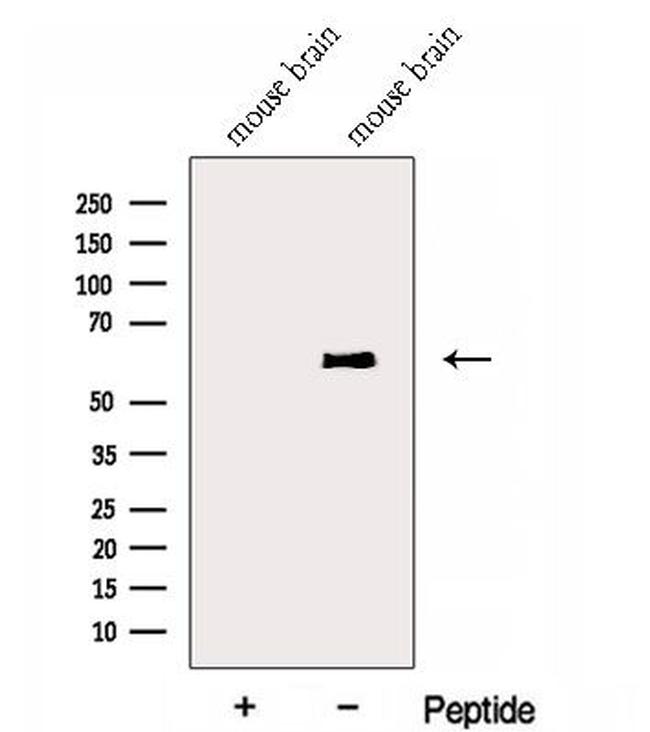 ENPP4 Antibody in Western Blot (WB)