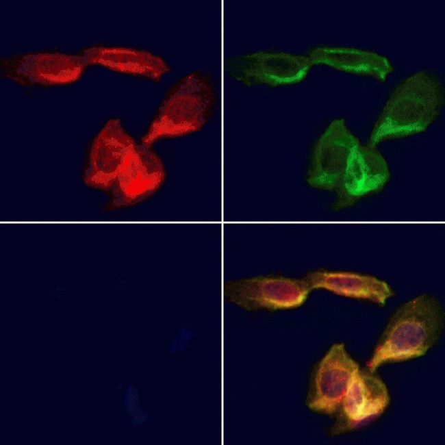 ERGIC2 Antibody in Immunocytochemistry (ICC/IF)