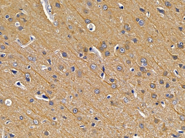 EXOSC10 Antibody in Immunohistochemistry (Paraffin) (IHC (P))