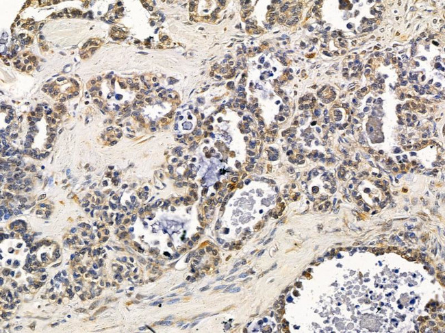 FAM46C Antibody in Immunohistochemistry (Paraffin) (IHC (P))