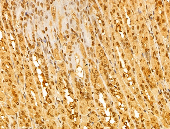 FBXL14 Antibody in Immunohistochemistry (Paraffin) (IHC (P))
