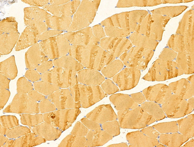 FBG4 Antibody in Immunohistochemistry (Paraffin) (IHC (P))