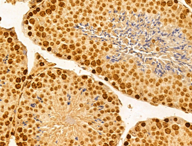 FBXW2 Antibody in Immunohistochemistry (Paraffin) (IHC (P))