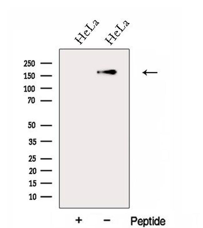 FGD5 Antibody in Western Blot (WB)