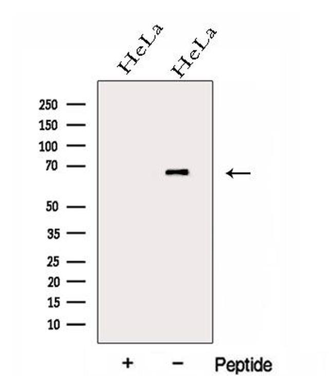 GALNT4 Antibody in Western Blot (WB)