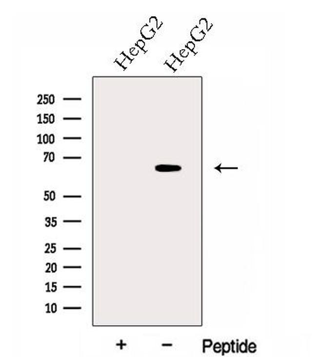 GPAA1 Antibody in Western Blot (WB)
