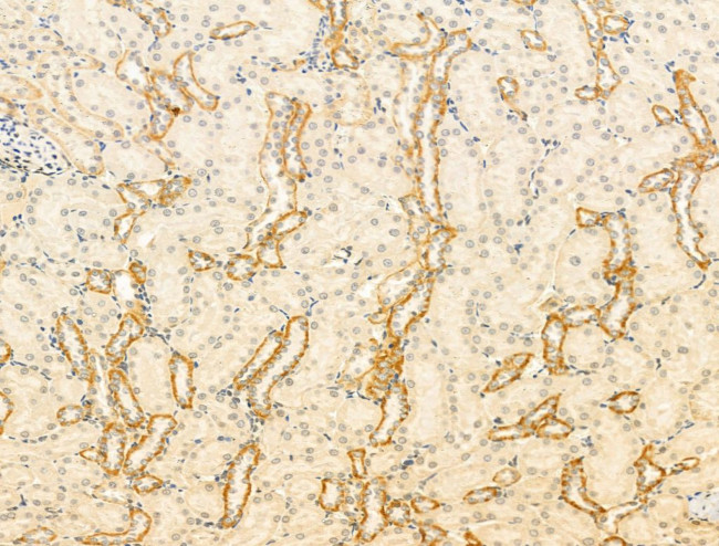 GPR177 Antibody in Immunohistochemistry (Paraffin) (IHC (P))