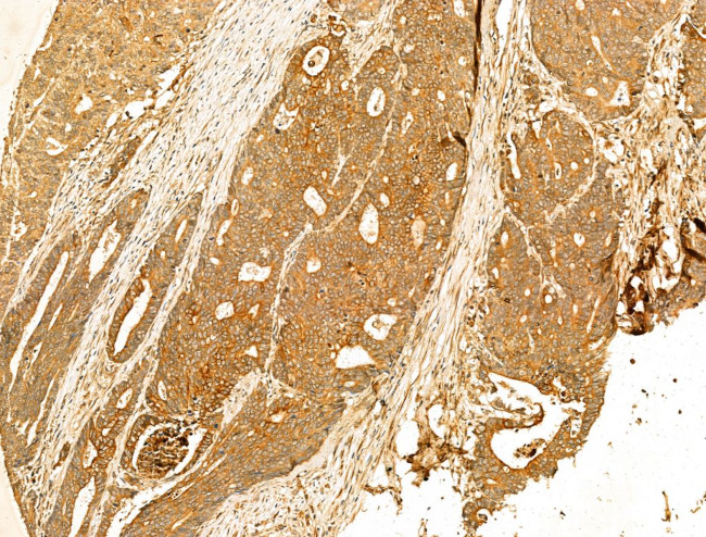 GPX8 Antibody in Immunohistochemistry (Paraffin) (IHC (P))