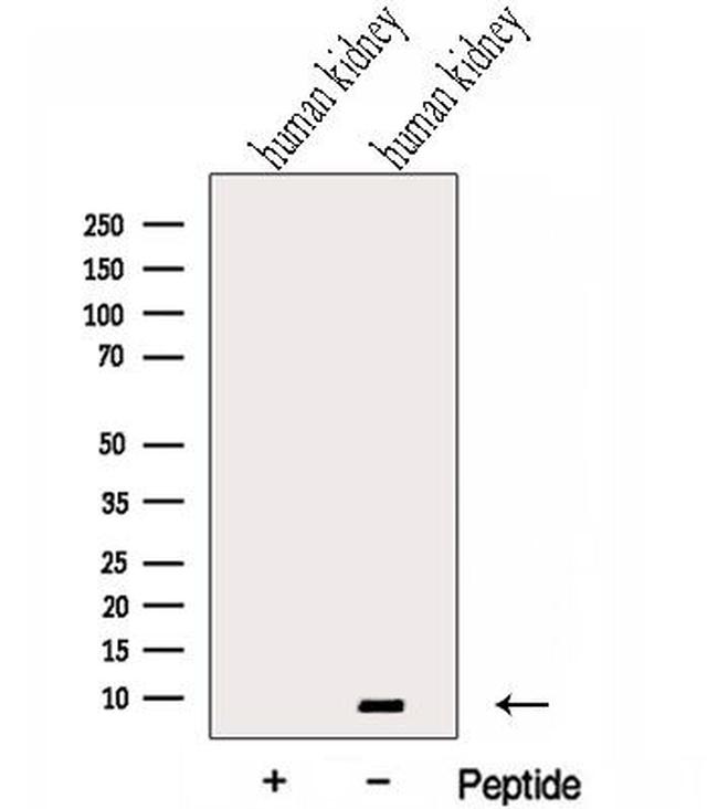 Gtf2h5 Antibody in Western Blot (WB)