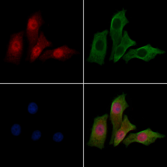 HEATR2 Antibody in Immunocytochemistry (ICC/IF)