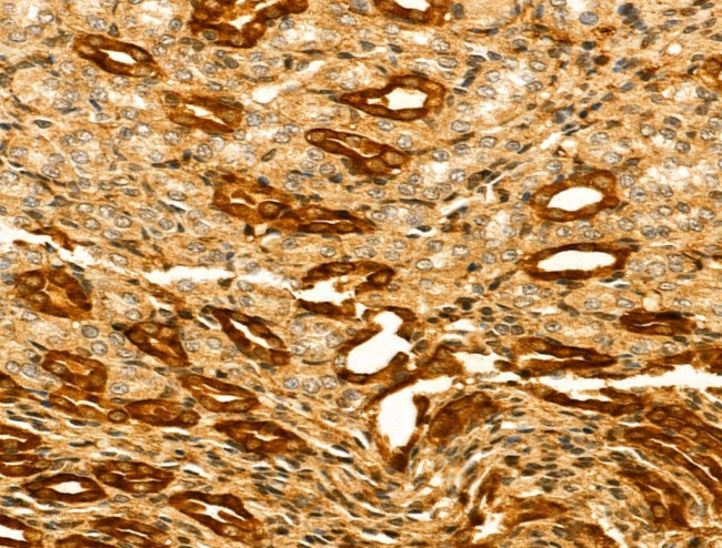 HERPUD2 Antibody in Immunohistochemistry (Paraffin) (IHC (P))
