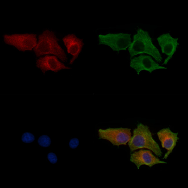 HIBCH Antibody in Immunocytochemistry (ICC/IF)