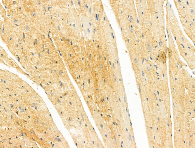 MIIP Antibody in Immunohistochemistry (Paraffin) (IHC (P))