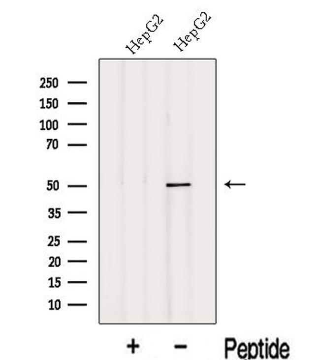 PHF22 Antibody in Western Blot (WB)