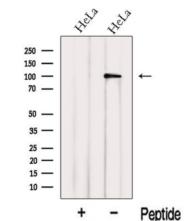 Importin 13 Antibody in Western Blot (WB)