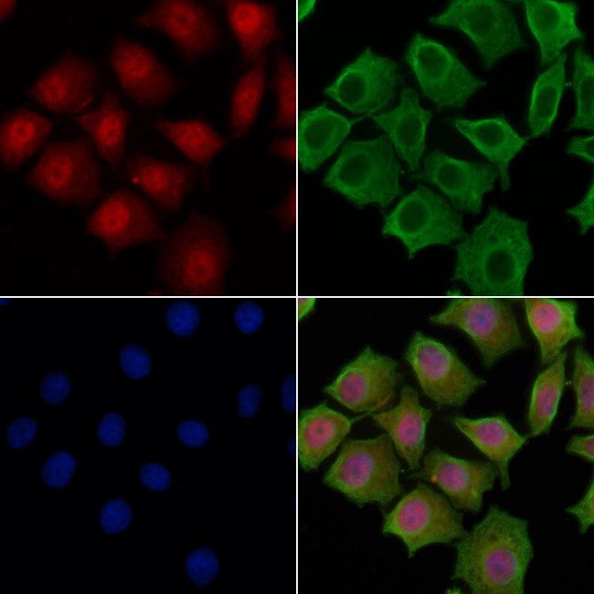 IRF2BP2 Antibody in Immunocytochemistry (ICC/IF)