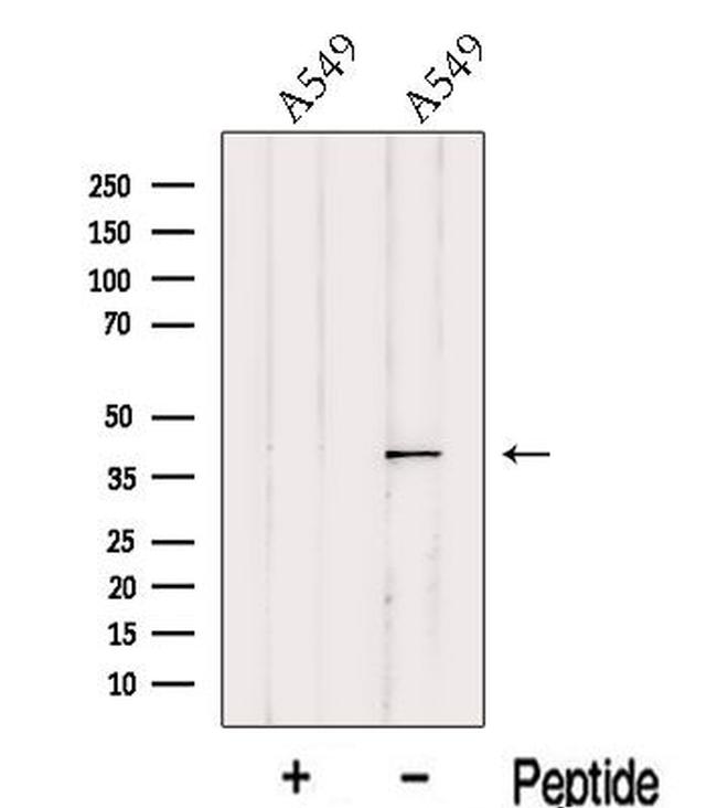 ITM2A Antibody in Western Blot (WB)