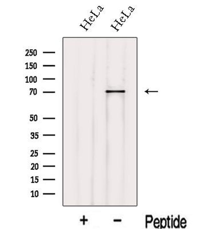 IVNS1ABP Antibody in Western Blot (WB)