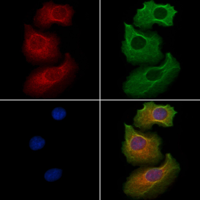 IYD Antibody in Immunocytochemistry (ICC/IF)