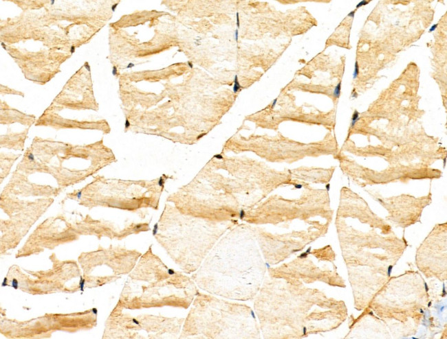 KLH18 Antibody in Immunohistochemistry (Paraffin) (IHC (P))